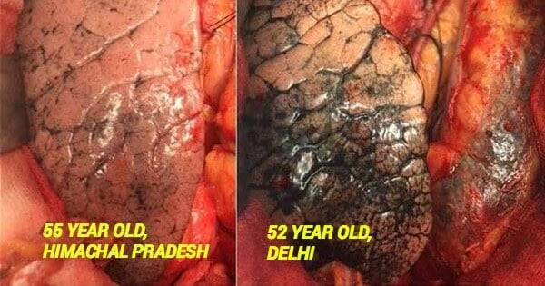 Head to toe, air pollution damages every organ in the body